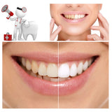 Charcoal Activated Teeth Whitening Powder